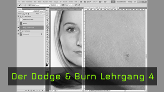 1456-dodgenburn_hautretusche-teaser-big.jpg
