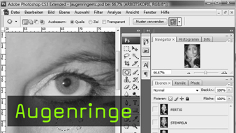 471-augenringe-teaser-gross.jpg 471-augenringe-teaser-gross.jpg