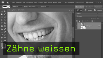 626-zaehneweissen-teaser-gross.jpg