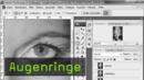 471-augenringe-teaser-klein.jpg
