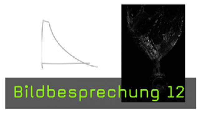 Bildbesprechung, Wirkungskurve