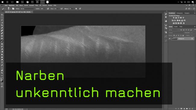 Narben in Photoshop unkenntlich machen