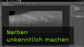 Narben in Photoshop unkenntlich machen