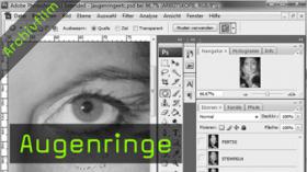 471-augenringe-teaser-gross.jpg